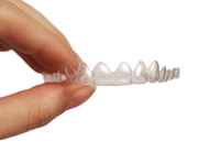 Invisalign Aligners